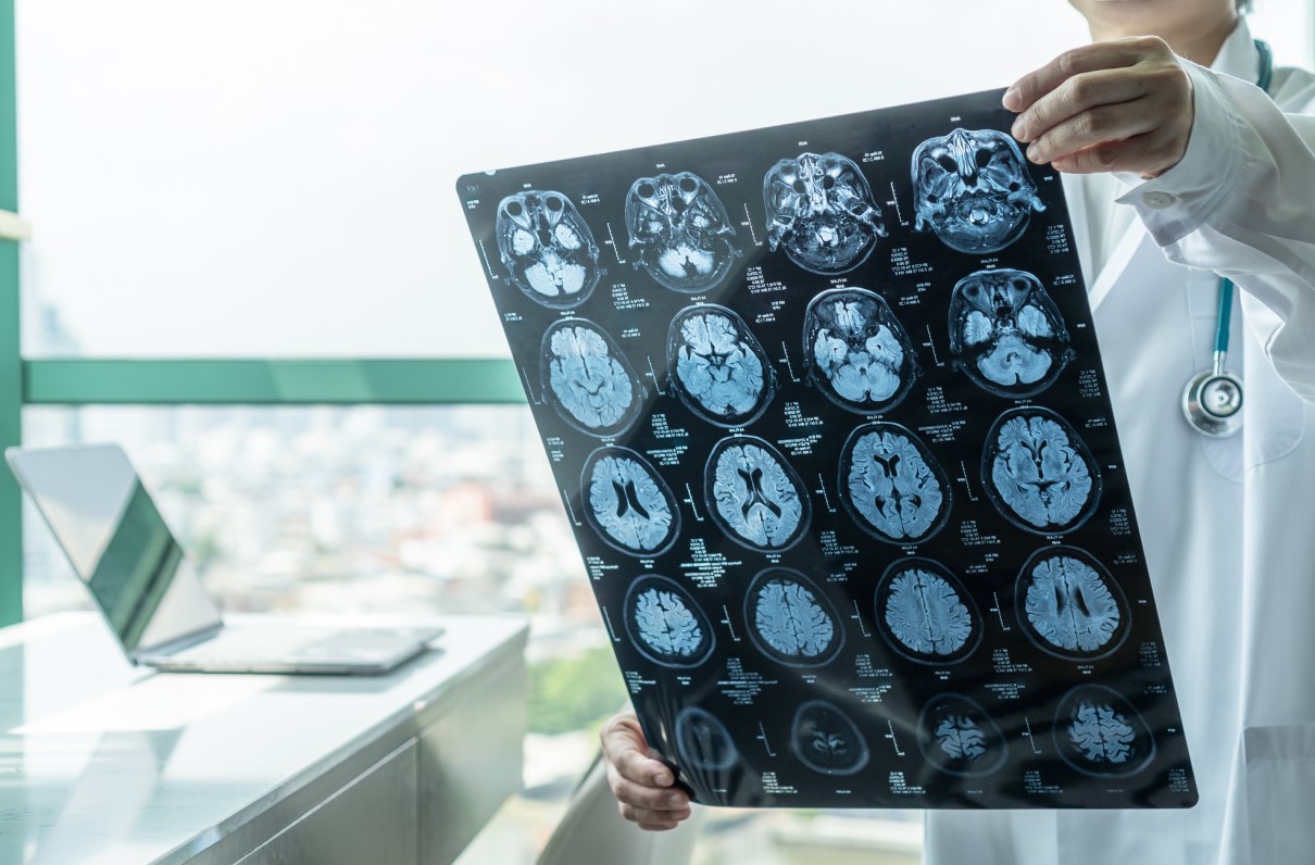 Veterans and Alzheimer’s: Resources and a Personal Journey 
